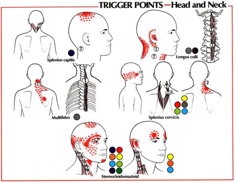 Cervical Referred Pain Patterns