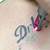Cheap Laser Tattoo Removal Los Angeles