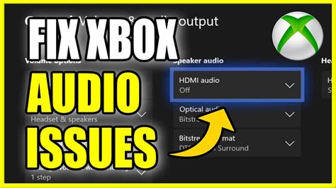 Check the Audio Settings on Your Xbox