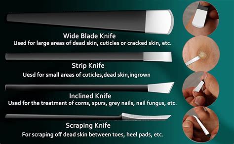 Chef Knife Callus