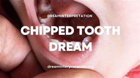The Heartbreaking Truth behind Your Dream of a Chipped Tooth