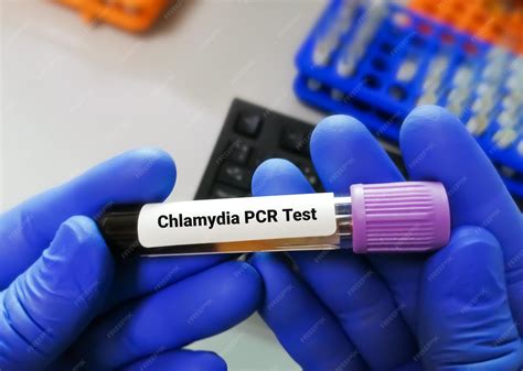 Chlamydia Trachomatis PCR Test and interpretation