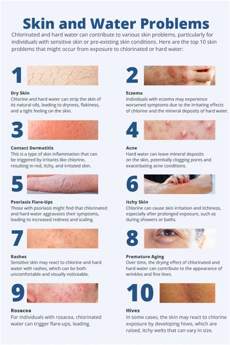 Discover the Amazing Benefits of Chlorine for Radiant Skin – Dive Deep into the Miracle of Chlorine!