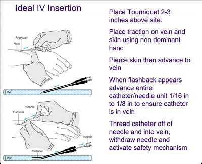 Choosing the Right Time for Insertion