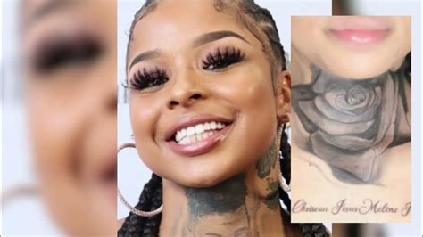 Chrisean Removes Tattoo