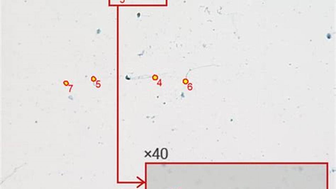 Christmas Tree Stain Cpt Code