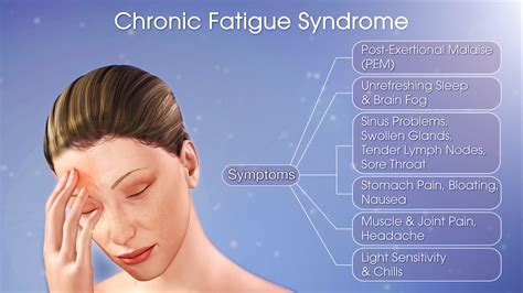 Chronic Fatigue Synd… 