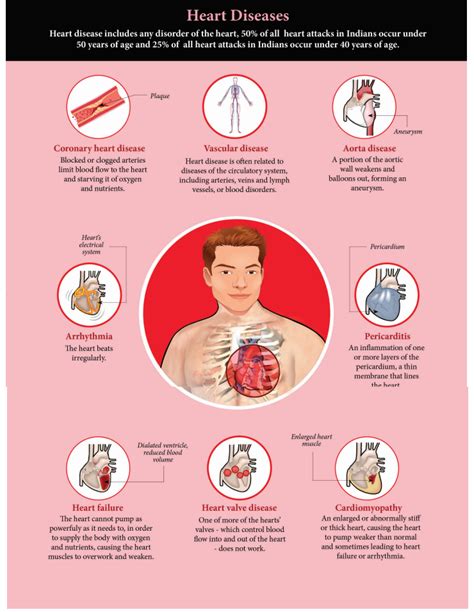 Circulatory System Disorders: Types & Solutions