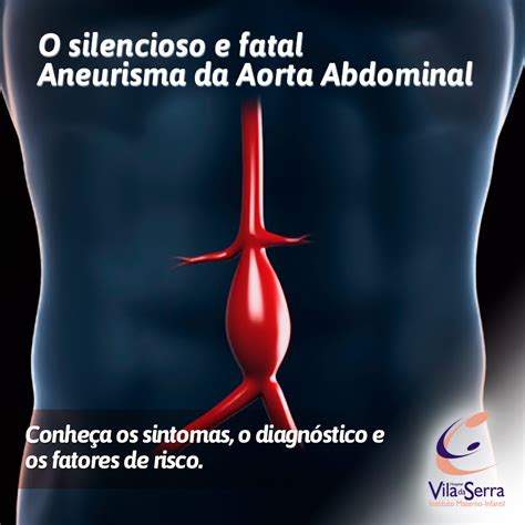 PPT - ANEURISMA DA AORTA ABDOMINAL – AAA PowerPoint Presentation, free