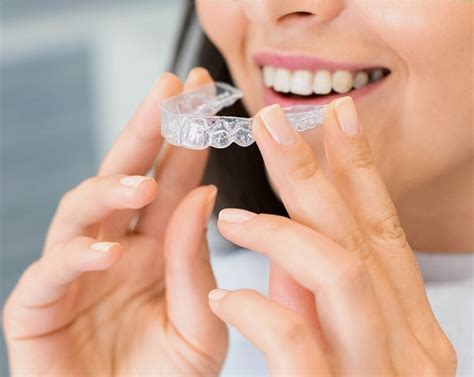 Clear Aligners (Invisalign)