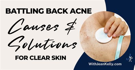 Clear Back Acne: Solutions That Work.