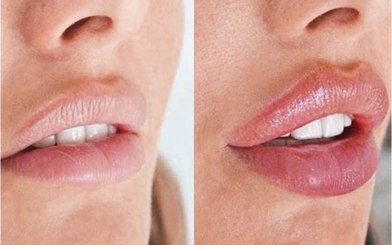 Closed Lips Method