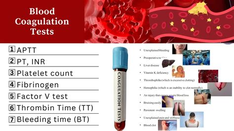 Coagulation Panel Test and interpretation