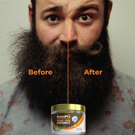 Coconut Oil For Beard