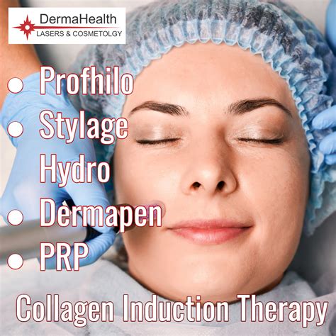 Collagen Induction Therapy Philadelphia Benefits