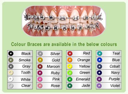 Color For Braces Chart