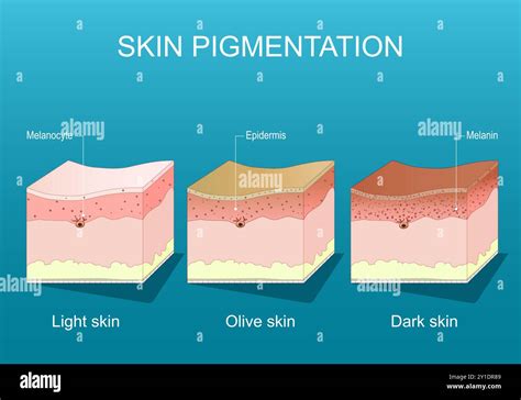 Color Range & Pigmentation