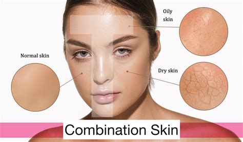 Combination Skin