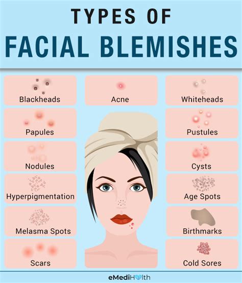 Common Causes Behind Blemish Skin