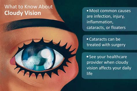 Common Causes of Sudden Cloudy Vision In One Eye