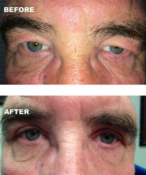 Common Challenges Affecting the Beyer Eye