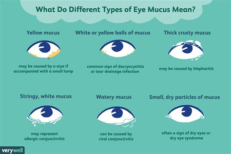 Common Culprits Behind Mucus From Eye