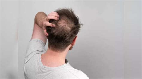 Common Culprits Behind Those Shadows