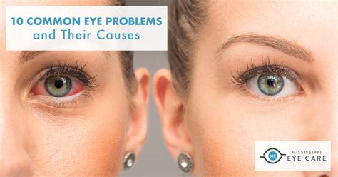 Common Eye Problems: Causes & Solutions