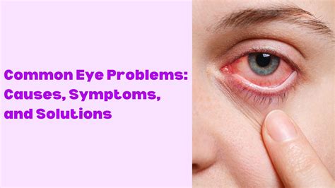 Common Eye Problems and Their Solutions