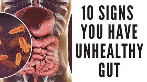 Common Gut Health Issues