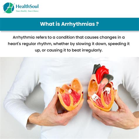 Common Health Issues Arrhythmia Causes