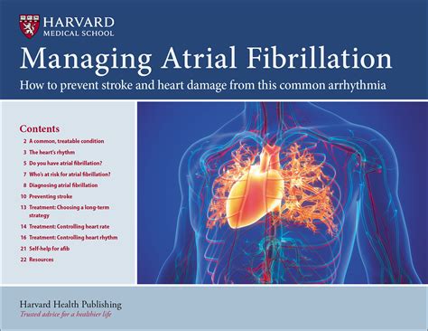 Atrial Fibrillation