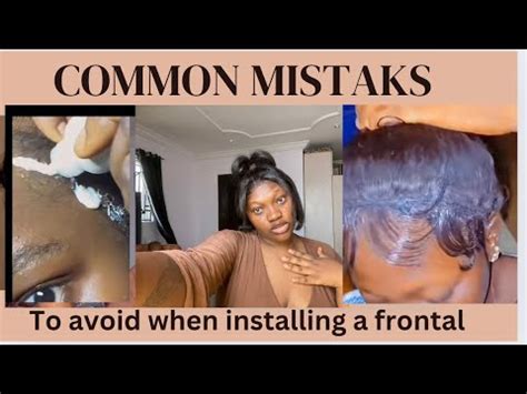 Common Mistakes to Avoid with Frontal Closure