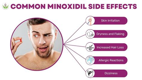 Common Side Effects Associated with Minoxidil