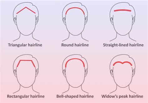 Comparing Frontal Hairline Solutions (Table)