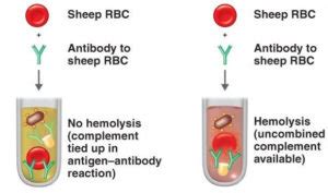 Complement Panel Test and interpretation