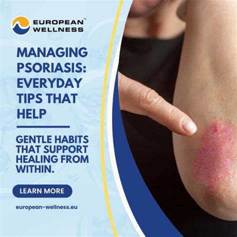 Complementary Tips for Managing Psoriasis Symptoms