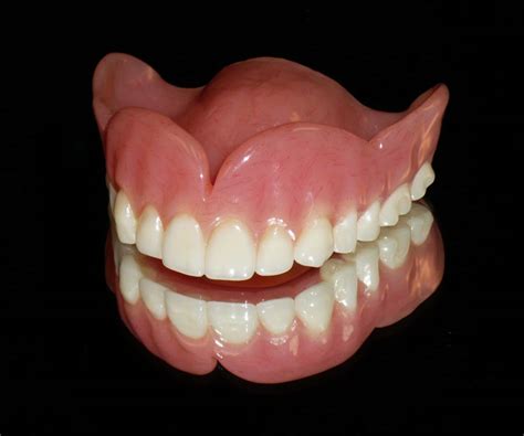 Upper Denture