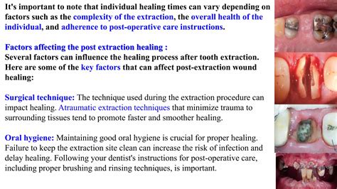 Complexity of the Tooth Extraction