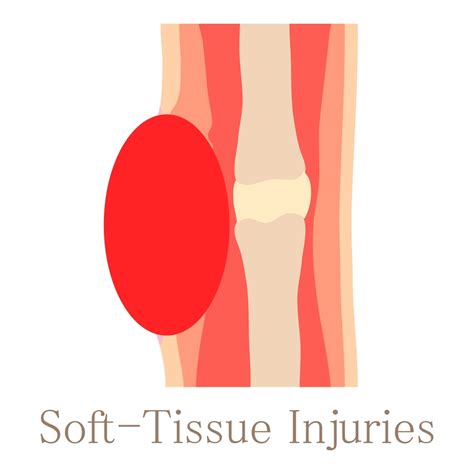 Complications of Untreated Soft Tissue Damage