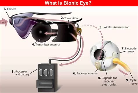 Components of a Bionic Eye System