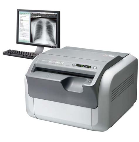 Radiography Reader