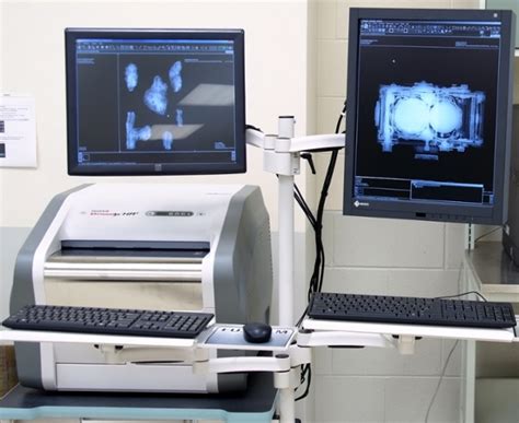 Digital Radiography