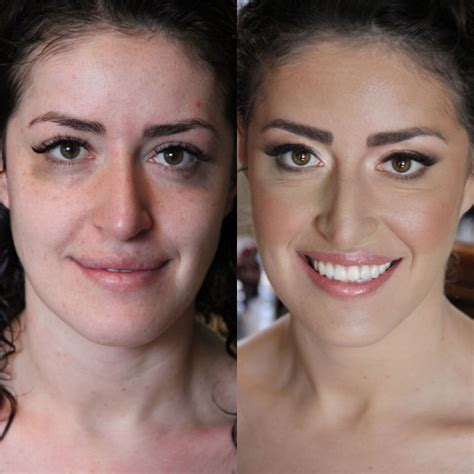 Concealer For Bruises