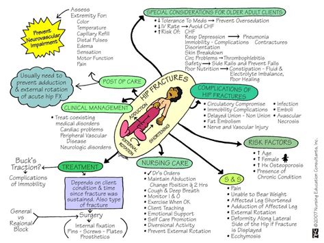 Hip fracture Mind map Geriatric nursing, Hip fracture, Nurse