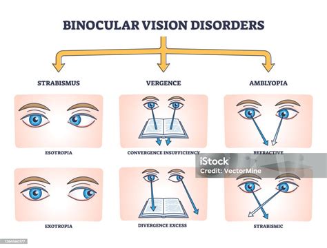 Contoh Soal Binokular