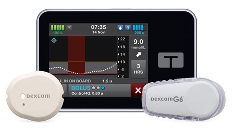 Control-IQ Technology A Closer Look