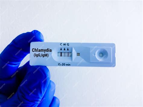Coping with a Positive Chlamydia Test