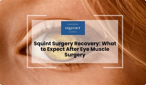 Correct Squint: Surgery, Recovery & Costs.