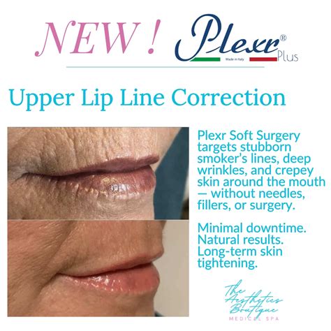 Cosmetic Procedures for Stubborn Lines